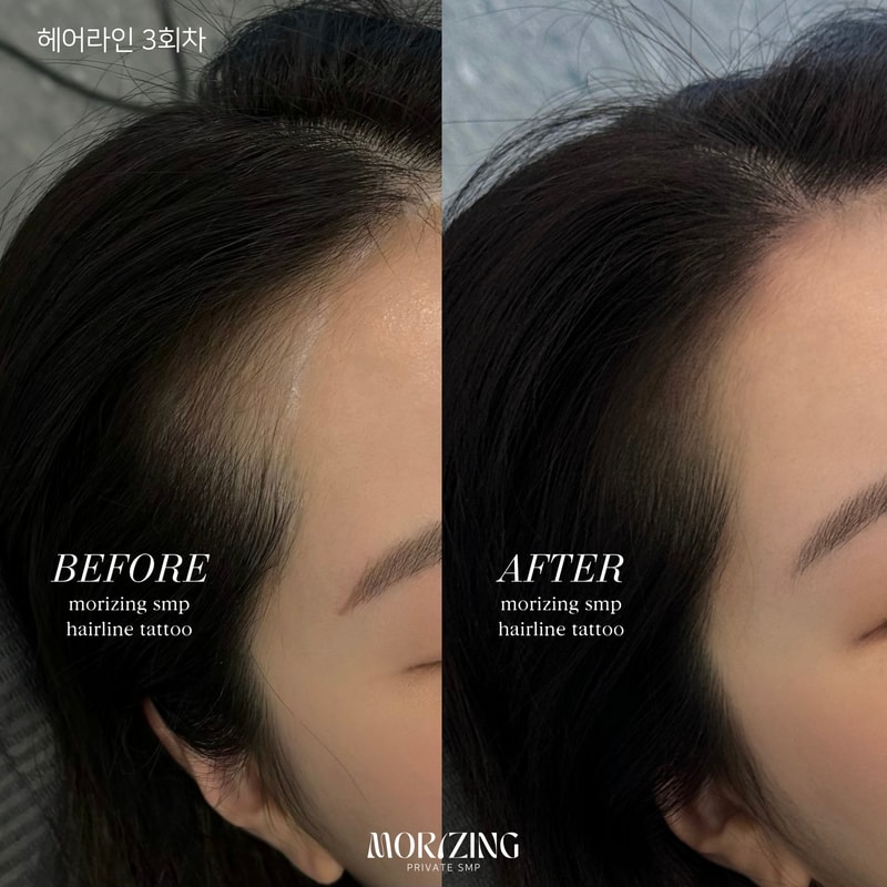 Beige and Blue Minimalist Beauty Skincare Before After Collage Instagram Post의 사본.png