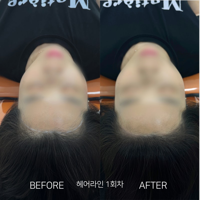 Beige and Blue Minimalist Beauty Skincare Before After Collage Instagram Post의 사본.png