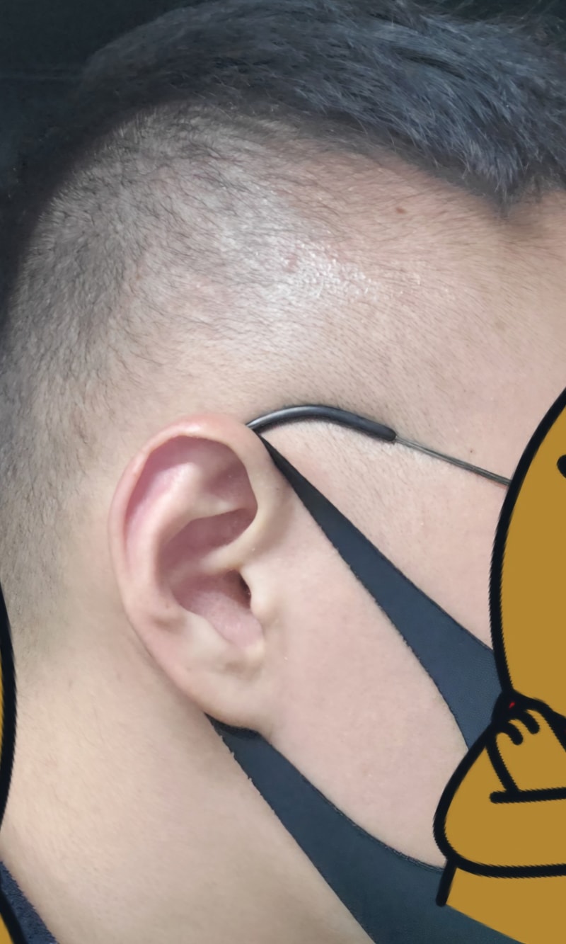 두피문신 하면 괜찮을까요?