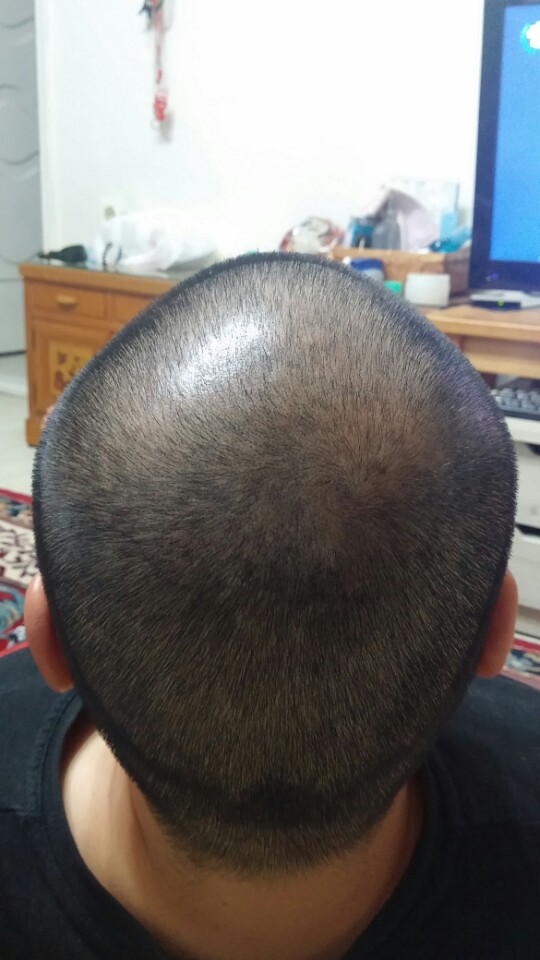 KakaoTalk_20170415_014352059.jpg