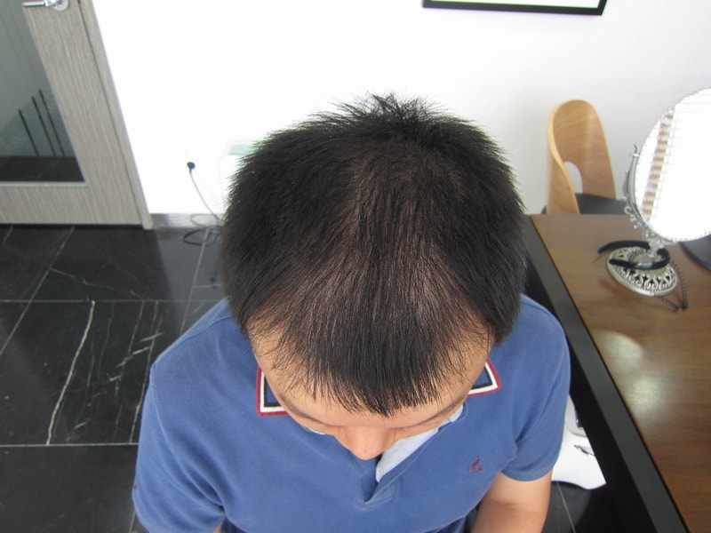 포맷변환_시술전.jpg