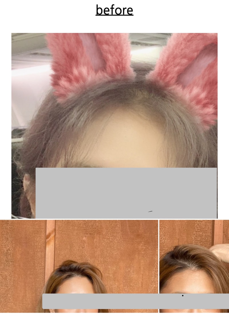두피문신 1년차입니다