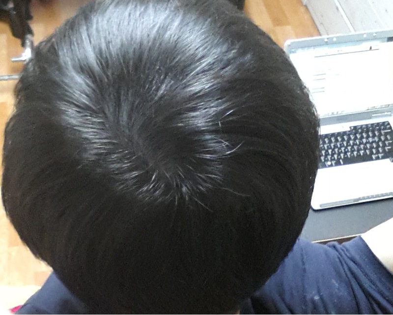 일반.jpg