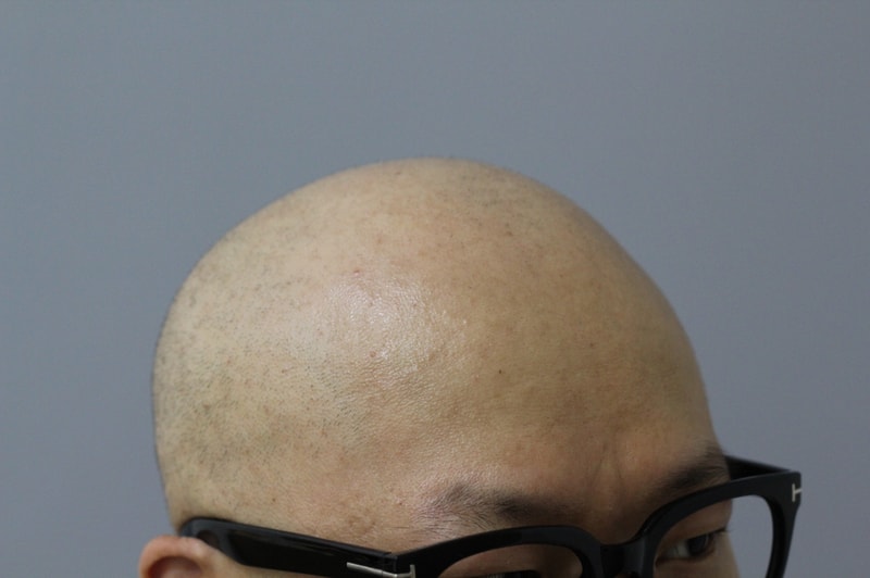시술전_IMG_2.JPG