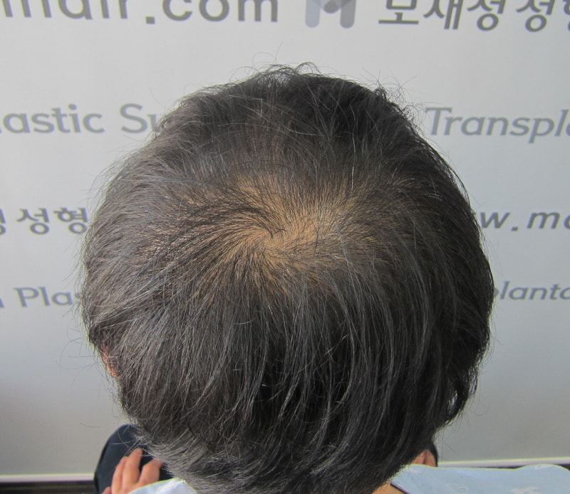 시술전4.JPG