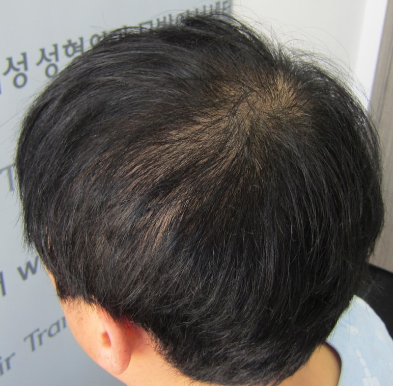 시술전3.JPG