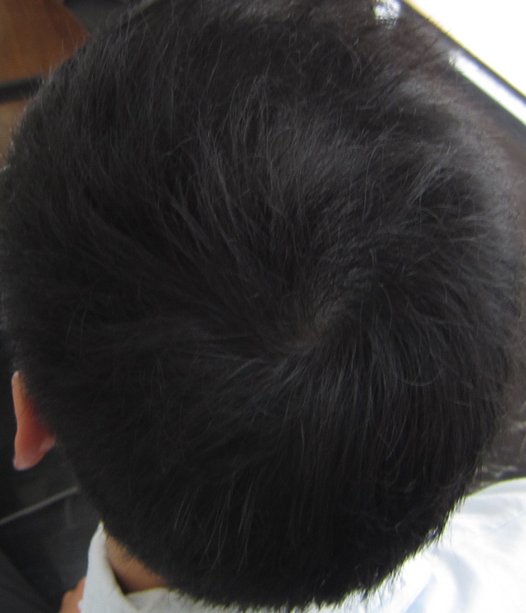 시술후2.JPG