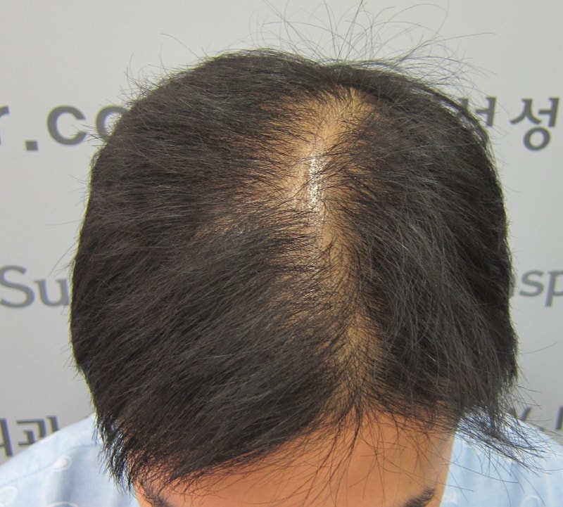 시술전1.JPG