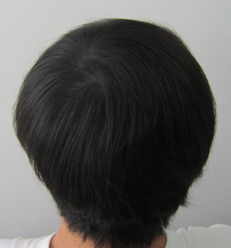시술후1.JPG