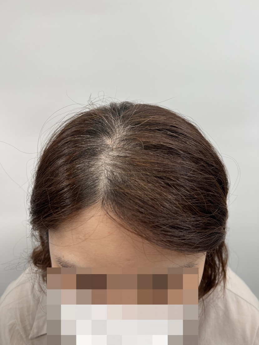 비포 2
