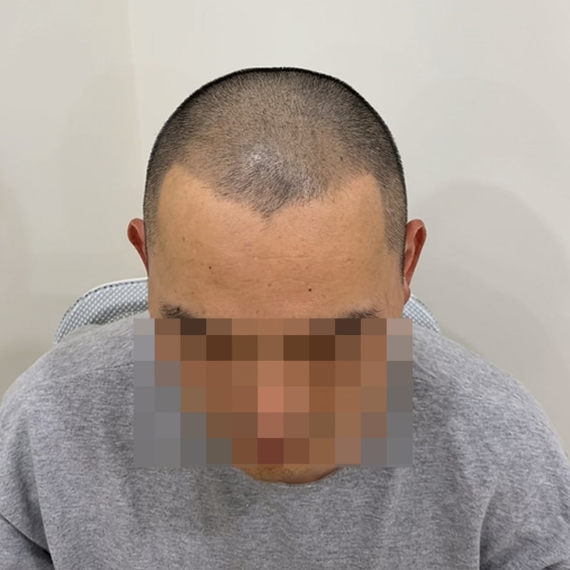 배근이형 에프터1.jpg