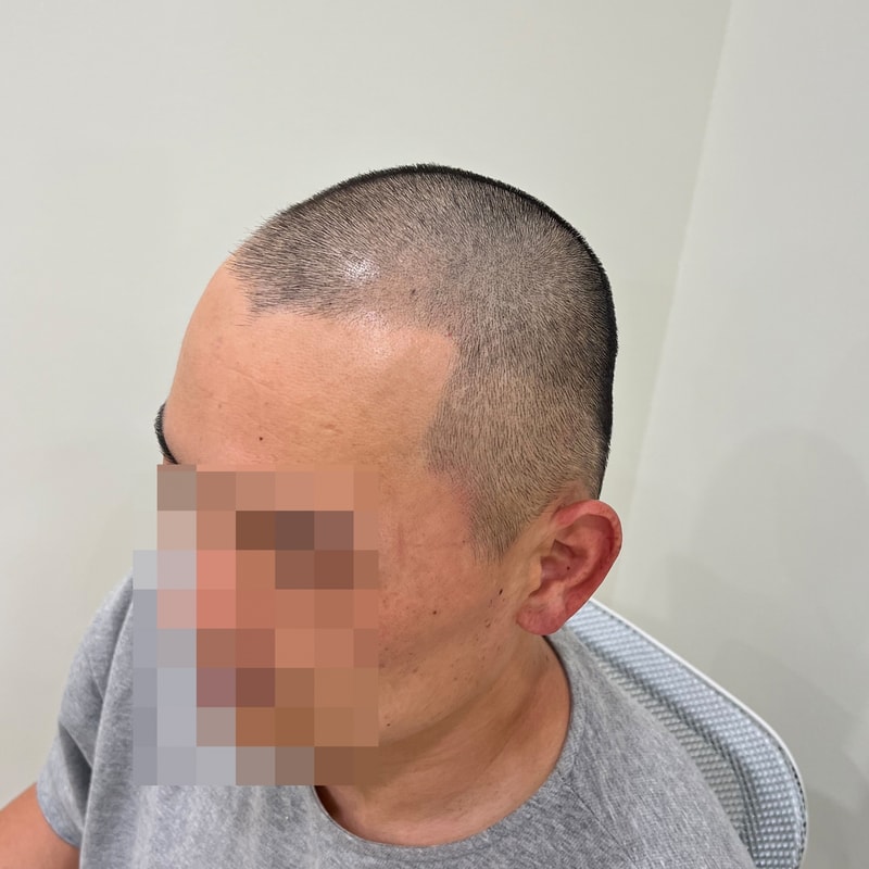 배근이형 에프터2.jpg