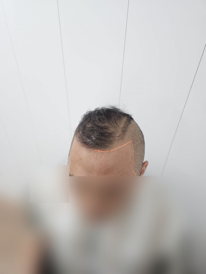 비포4.jpg