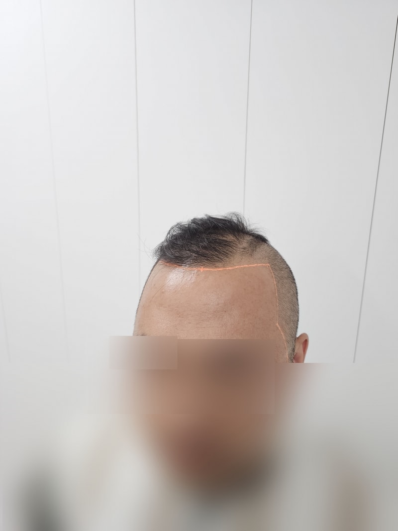 비포5.jpg