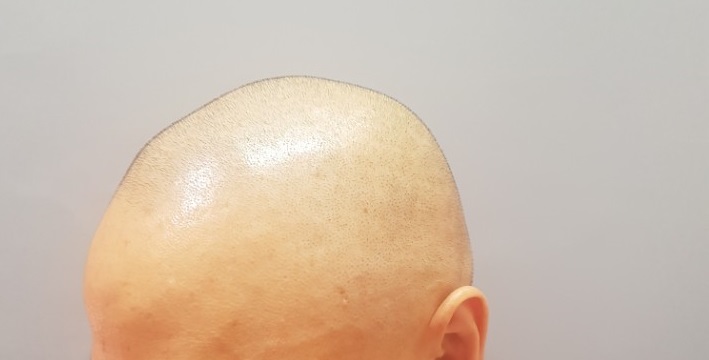 KakaoTalk_20180127_215705368.jpg