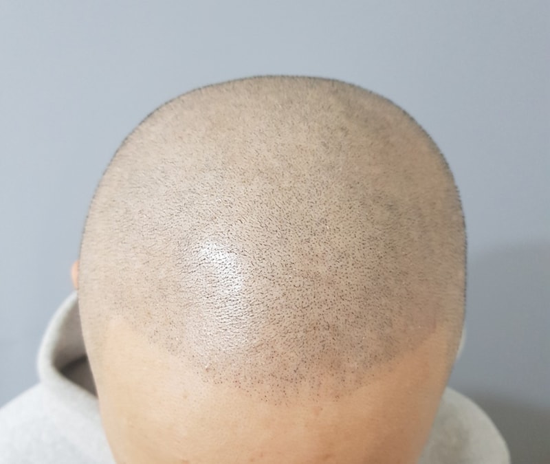 KakaoTalk_20180315_191326918.jpg