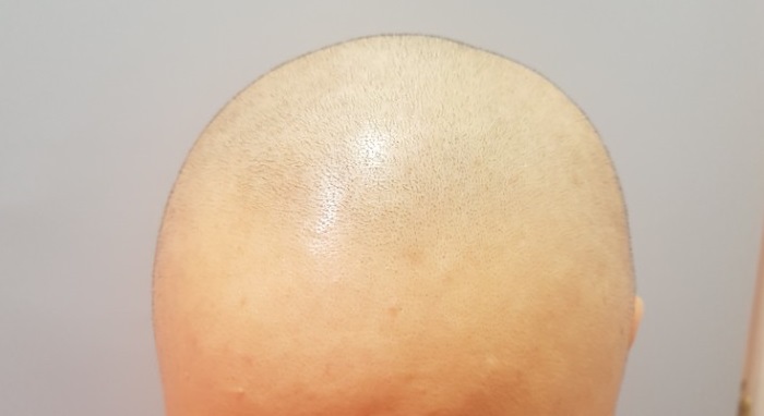 KakaoTalk_20180127_215610571.jpg