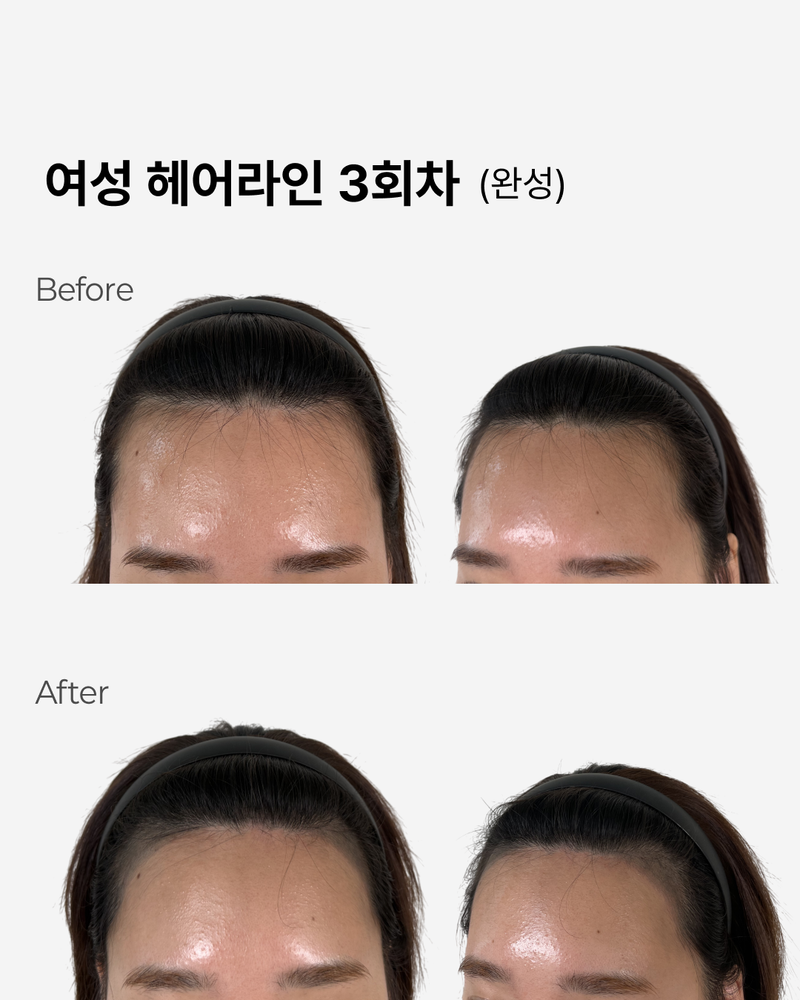 모델구인_헤어라인1.png