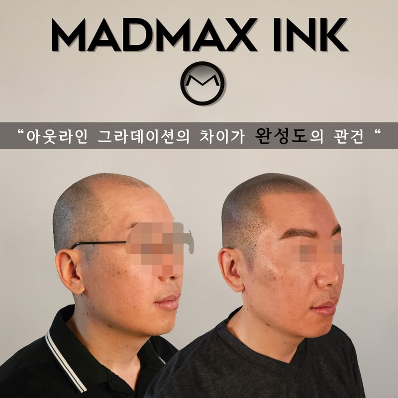 230503_천안두피문신.jpg