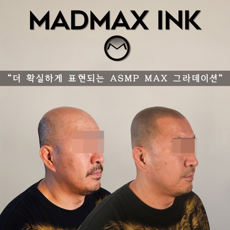 230731_천안두피문신.jpg