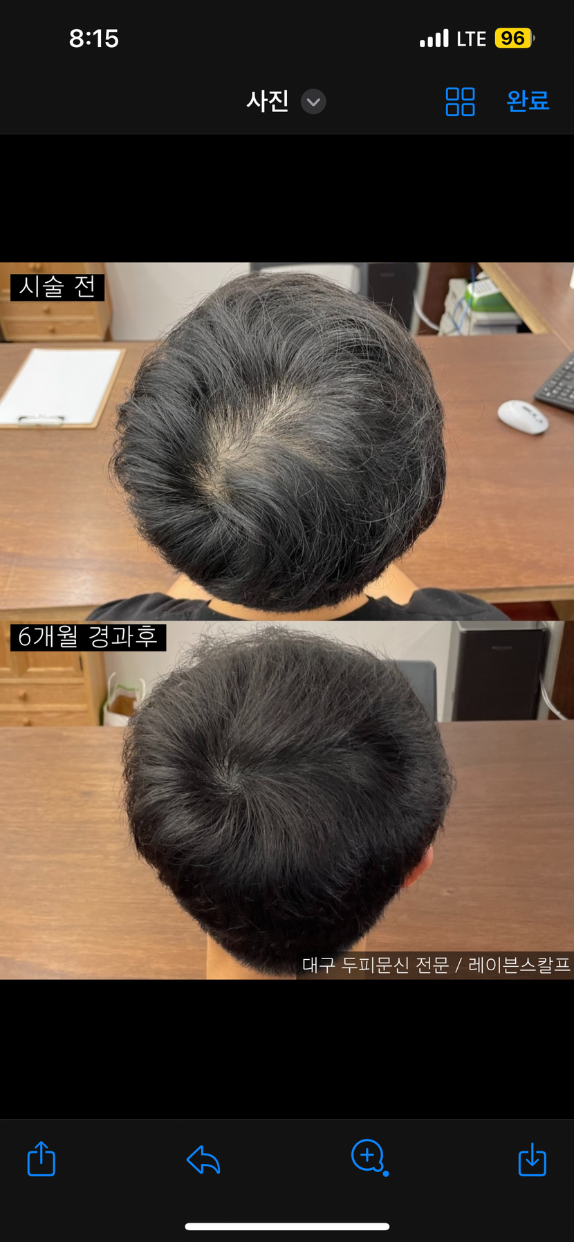 업체에서 찍은 사진입니다 전/후 입니다