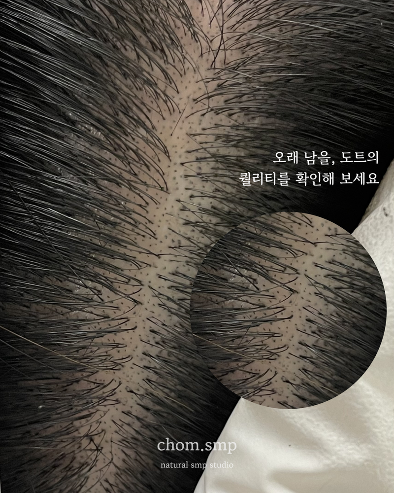 도트확대.png