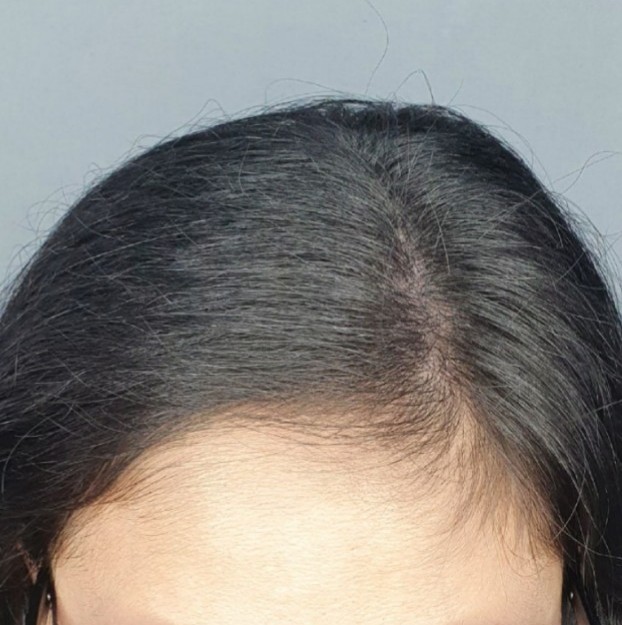 B612_20201106_025817_406~3.jpg