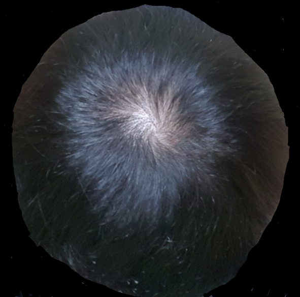 11.png