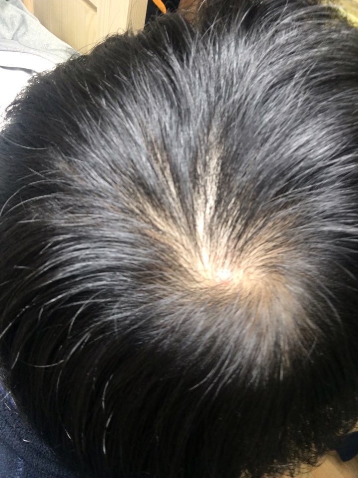 머리.jpg