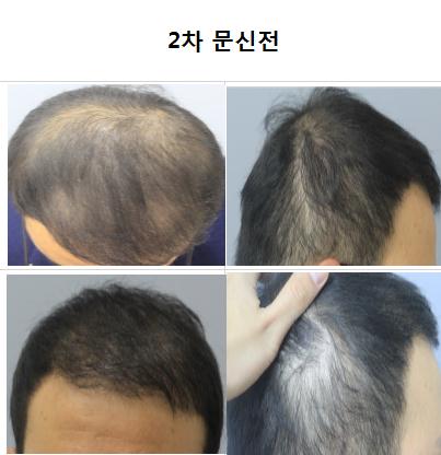 2차 문신전.jpg