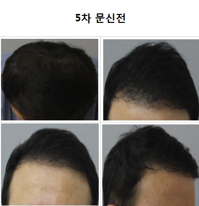 5차 문신전.jpg