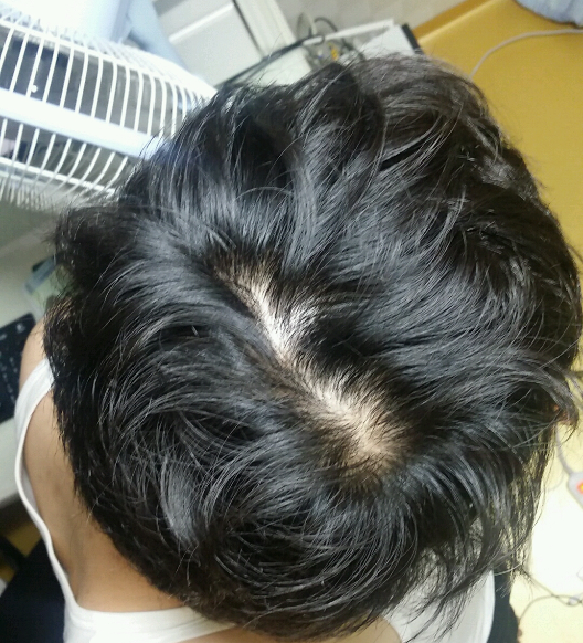 내정수리.png