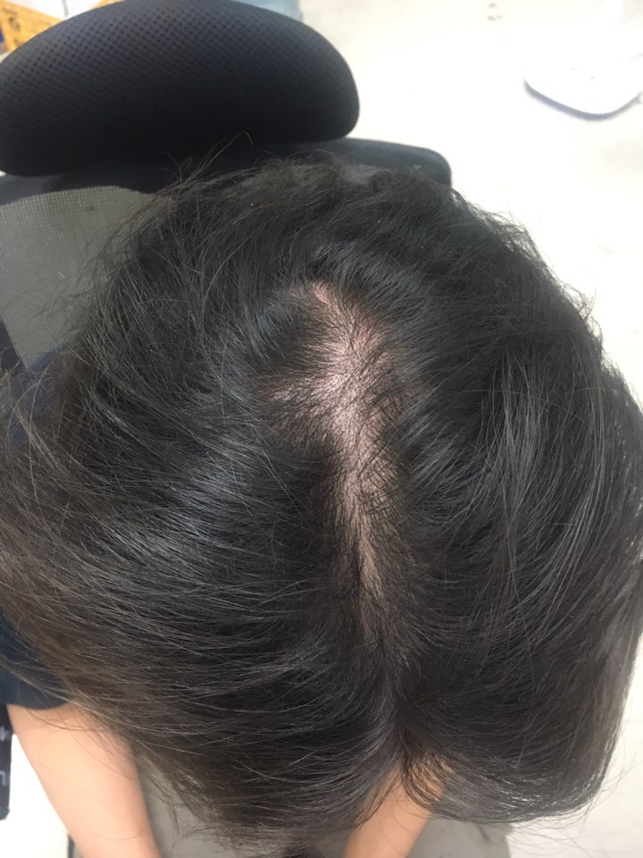 KakaoTalk_20170925_200841136.jpg