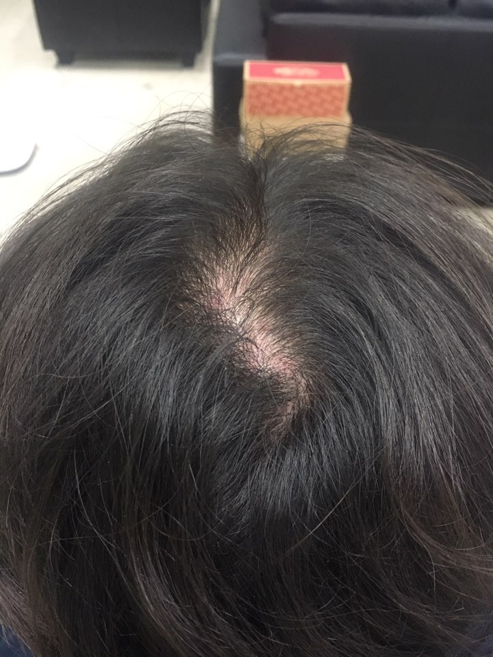 KakaoTalk_20170925_200840279.jpg