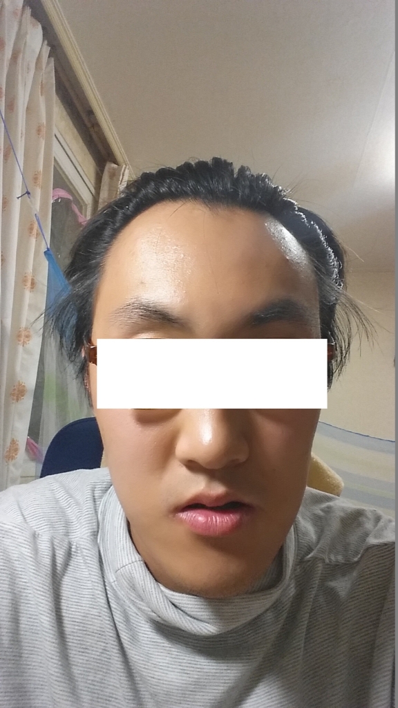 정면 이마와 얼굴 넓이 사진