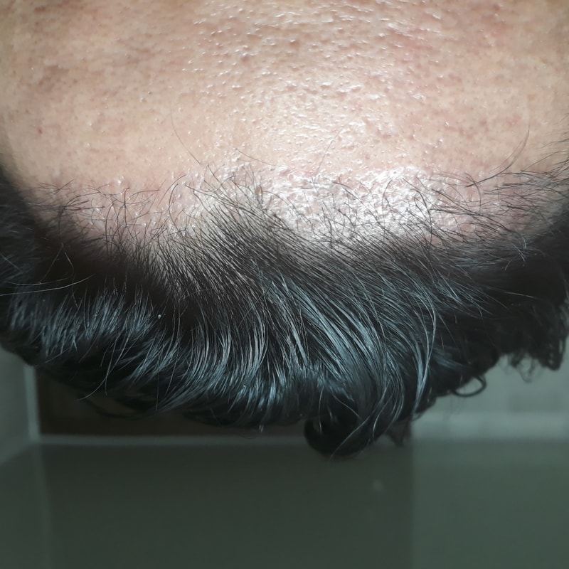 20181113_065345.jpg