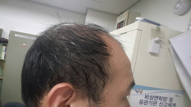 측면.jpg