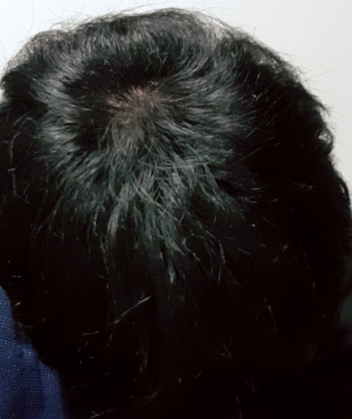 KakaoTalk_20181221_215022001.jpg