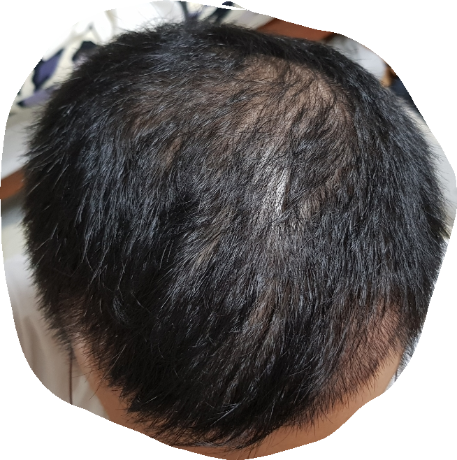 SmartSelect_20180719-211631_Gallery.png