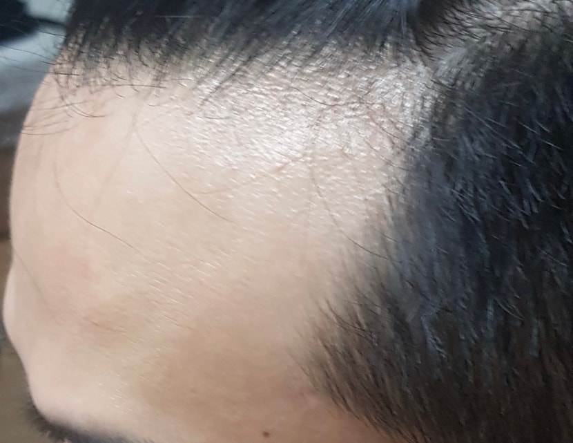 3년전