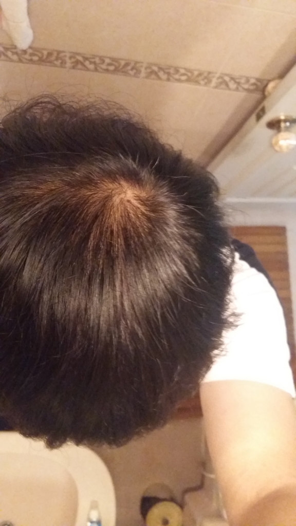 20150614_202033.jpg