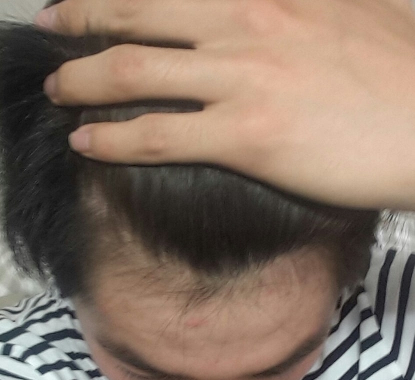 1년후