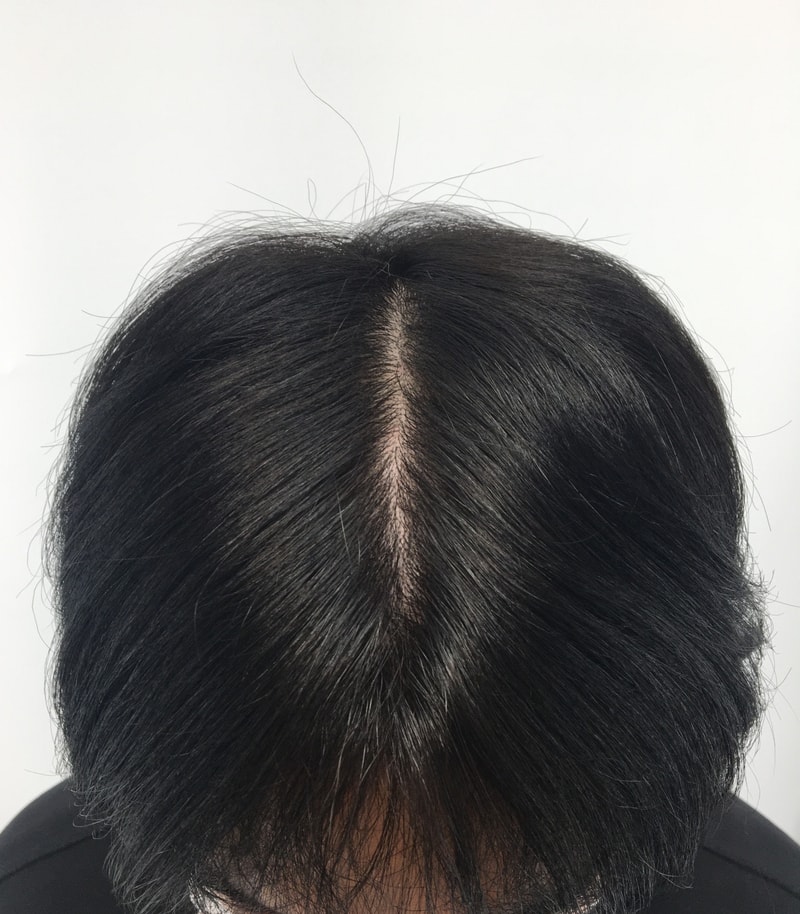 머리.jpg