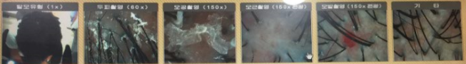 두피두피.PNG