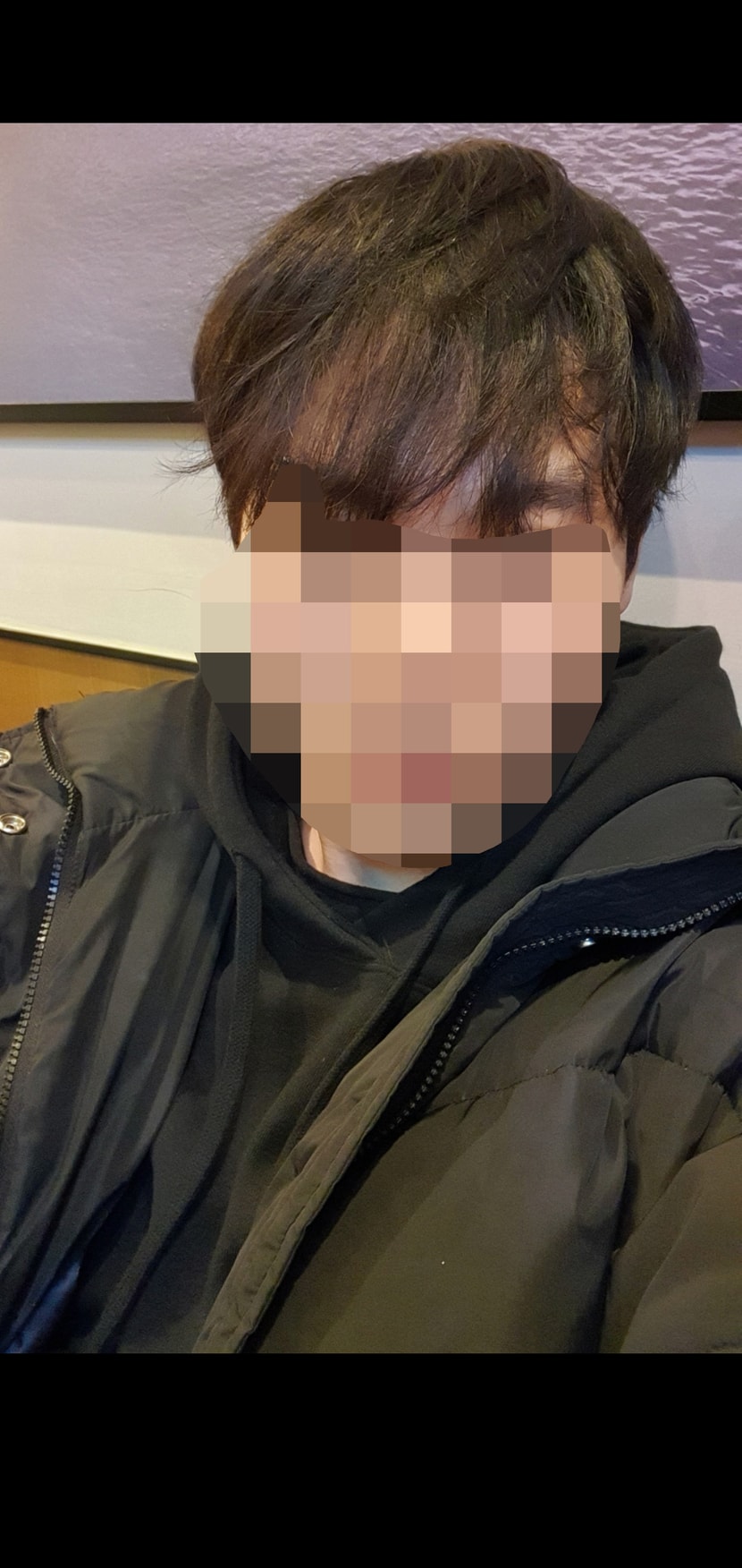 2019년 겨울 사진인데.. 처음보다 증모술 두배 가까이 넣는데도 땀 좀만 나도 이렇게 갈라집니다... 증모술 해보신분들은 아실거에요 앞머리 뭉태기 보이는게 증모술인거.. 이것저것 섞어서 해서 얇은것들도 물론 있습니다. 한가닥씩하는건 많이 할수록 너무 비싸져서 조금밖에 못했어요