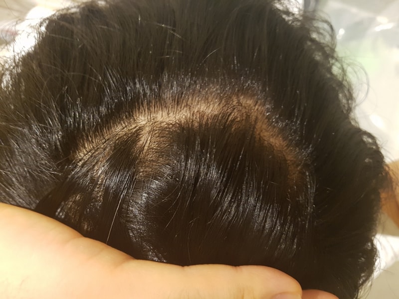 20180317_104336.jpg