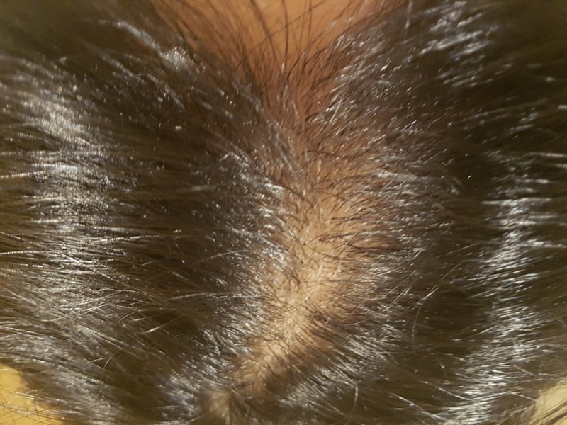 20180317_103619.jpg