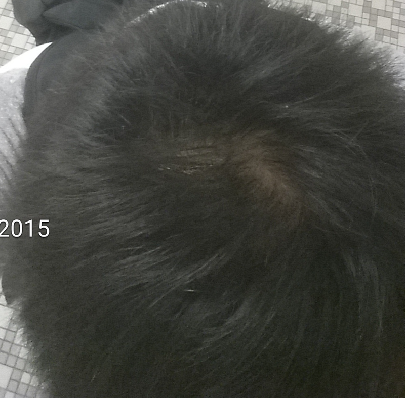 20150715_225747.png