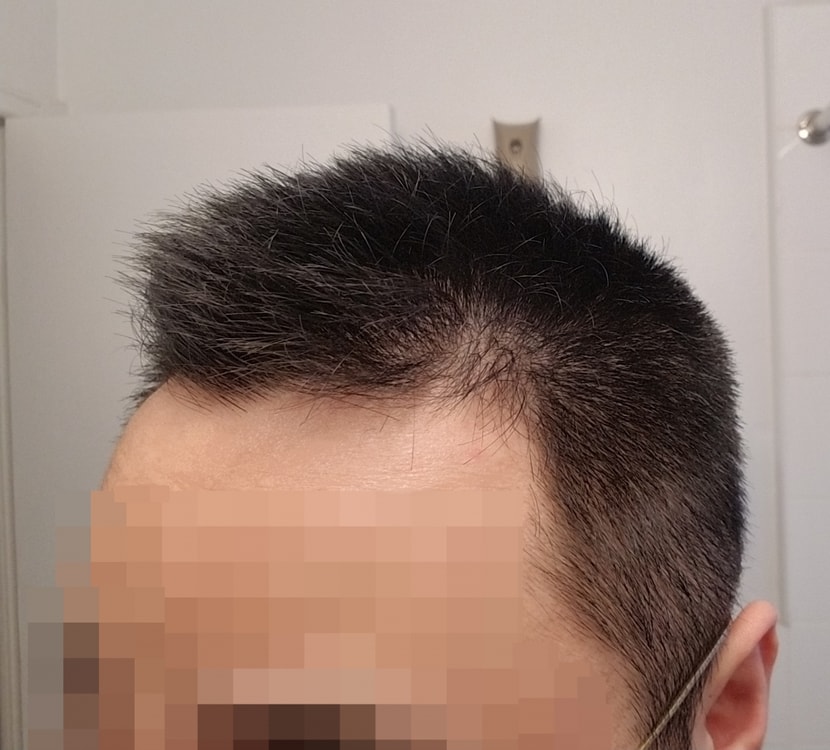 평상시 머리 좌측 더 가까이.