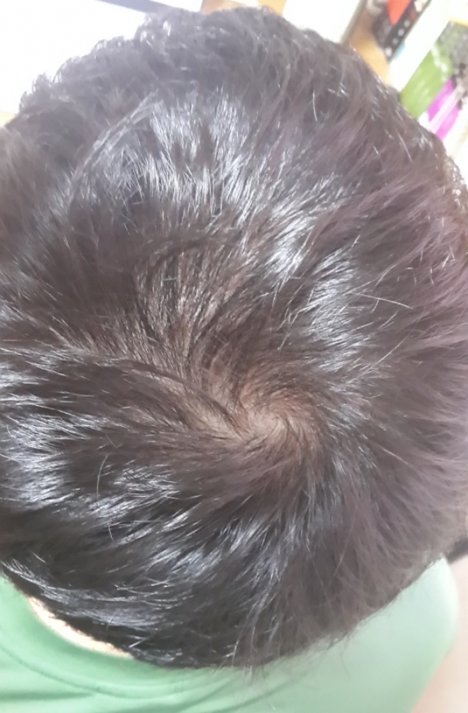 으헉.jpg